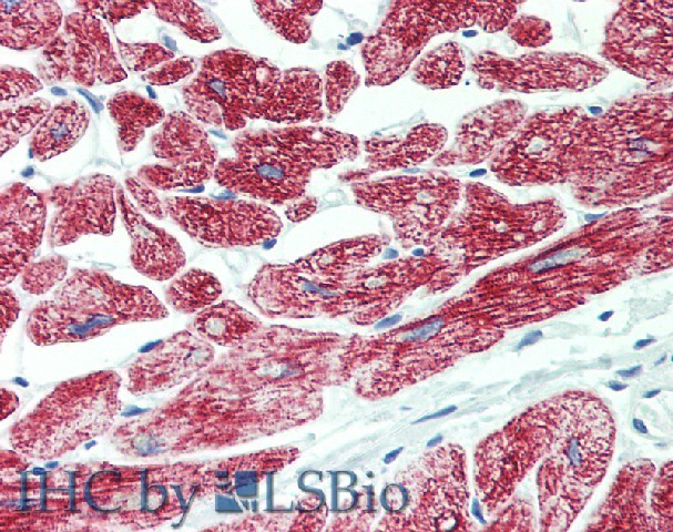 Immunohistochemistry of paraffin-embedded Heart tissue using ROR1 Polyclonal Antibody at dilution of 1:90 (Elabscience Product Detected by Lifespan).