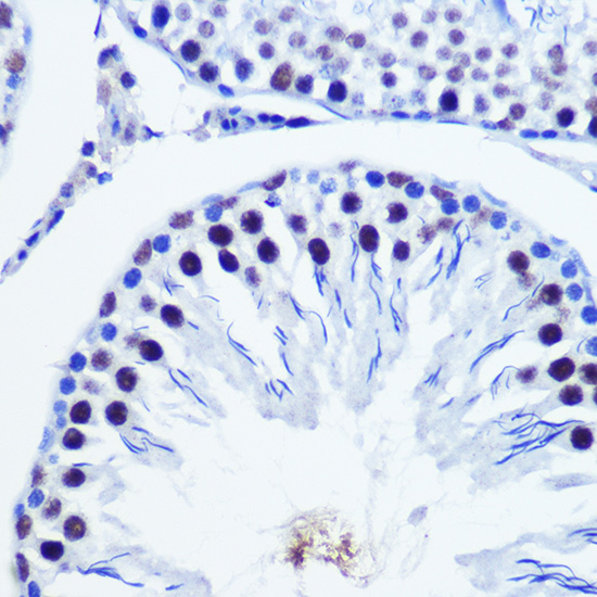 Immunohistochemistry of paraffin-embedded Rat testis using Vgll4 Polyclonal Antibody at dilution of 1:100 (40x lens).Perform microwave antigen retrieval with 10 mM Tris/EDTA buffer pH 9.0 before commencing with IHC staining protocol.