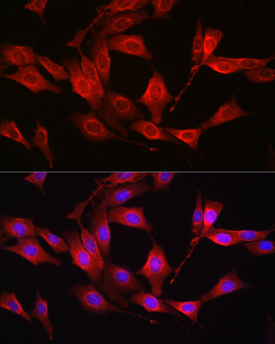 Immunofluorescence analysis of NIH/3T3 cells using [KO Validated] Glutathione Synthetase (GSS) Polyclonal Antibody at dilution of 1:100 (40x lens). Blue: DAPI for nuclear staining.