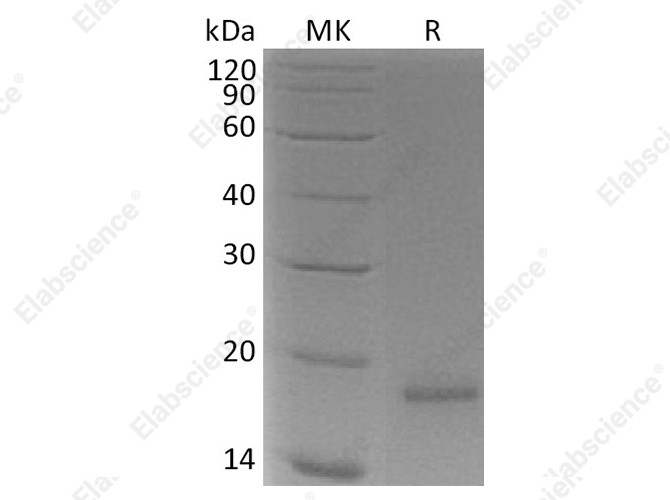 Recombinant Human CLDN18.1 /CLDN18 Protein (His Tag) - 1