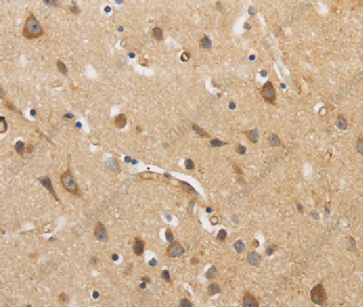 ARF6 Polyclonal Antibody - 3