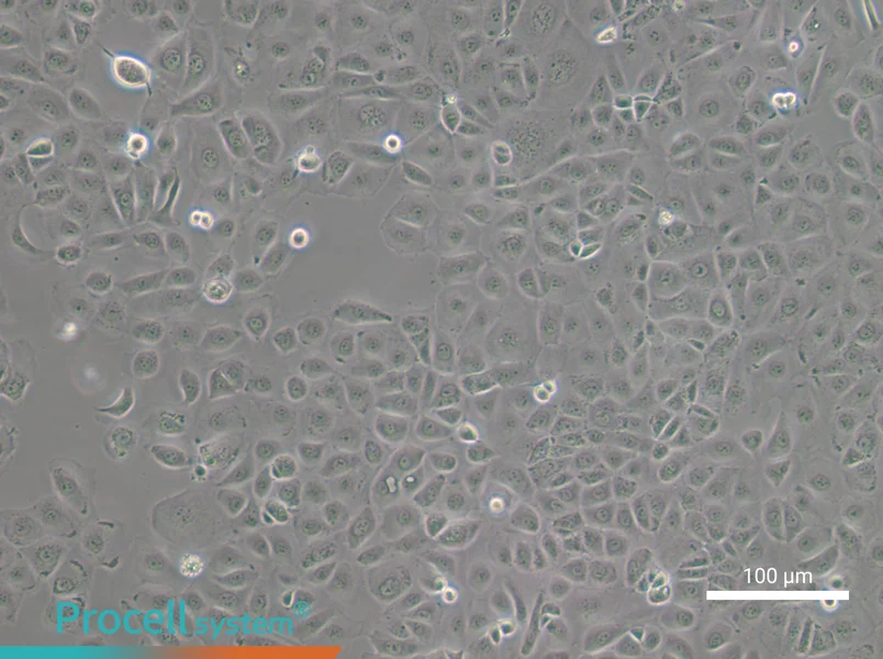 NIH:OVCAR-3 [OVCAR3]NIH:OVCAR-3 [OVCAR3] - 3
