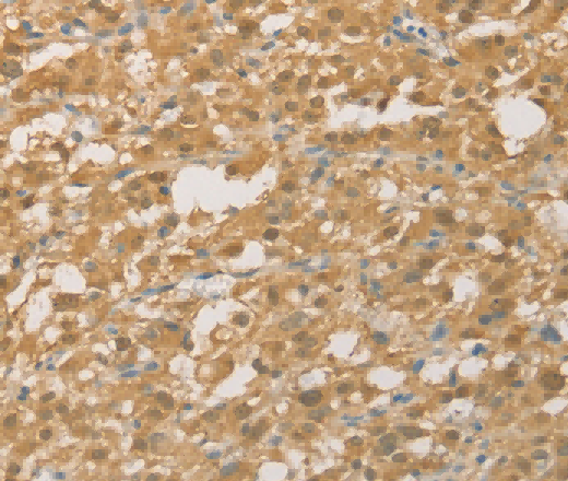 PGK2 Polyclonal Antibody - 2