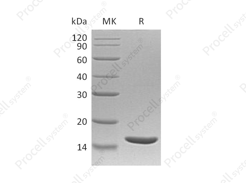 TNF-&beta;/TNFB/TNFSF1, Human, Recombinant