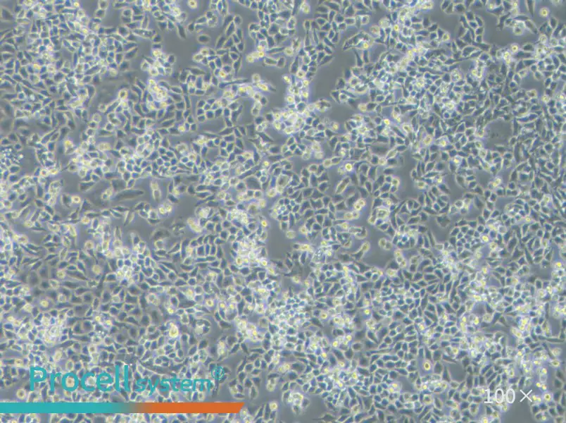 TOV-21G Cell Complete Medium - 1