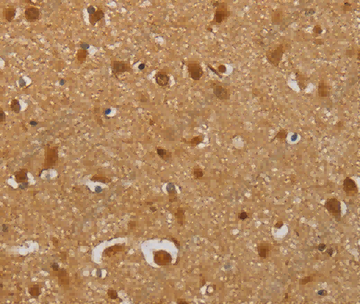 AHSG Polyclonal Antibody - 3