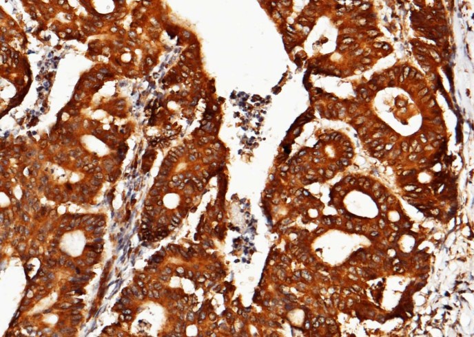 Recombinant ORP150/ORP150/HYOU1/HSP12A Monoclonal Antibody-searchlist-1