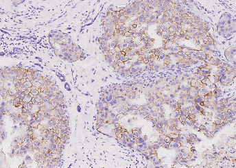 Recombinant HER2/ErbB2/CD340 Monoclonal Antibody - small - 3