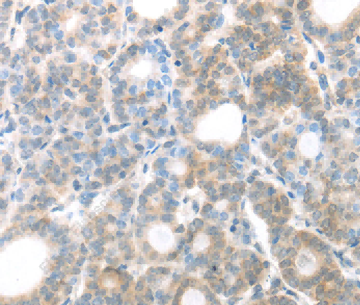 MAGED1 Polyclonal Antibody - 3
