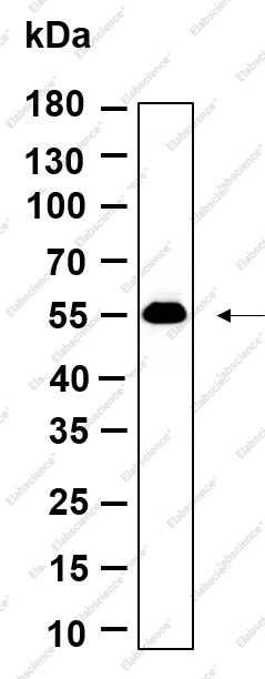 Recombinant p53 (Acetyl Lys382) Monoclonal Antibody - 1