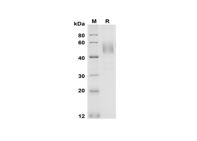Recombinant Rat Fas/TNFRSF6/CD95 Protein(Fc Tag)-1