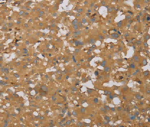 AHSG Polyclonal Antibody - 2