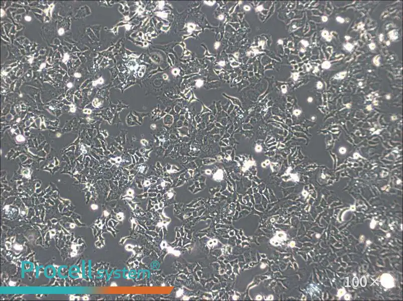 Ishikawa Cell Complete Medium - 2