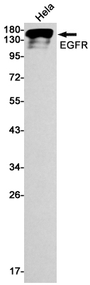 Western blot detection of EGFR in Hela cell lysates using EGFR Rabbit mAb(1:1000 diluted).Predicted band size:134kDa.Observed band size:175kDa.