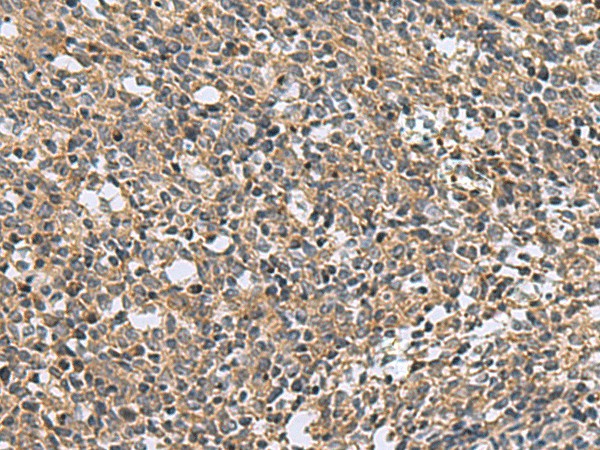 Immunohistochemistry of paraffin-embedded Human tonsil tissue  using EARS2 Polyclonal Antibody at dilution of 1:30(?200)