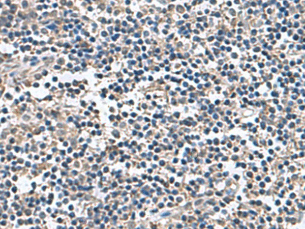 Immunohistochemistry of paraffin-embedded Human tonsil tissue  using BLOC1S6 Polyclonal Antibody at dilution of 1:60(?200)