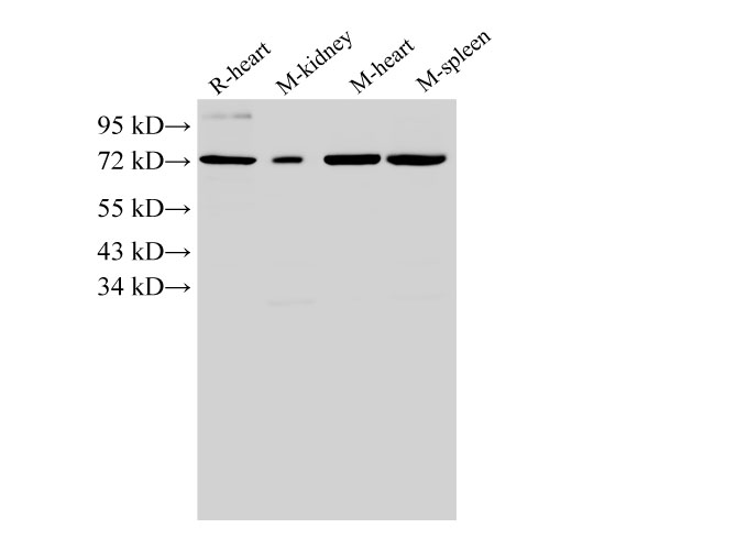 Western Blot analysis of Rat heart, Mouse kidney, Mouse heart and Mouse spleen using ANXA6 Polyclonal Antibody at dilution of 1:2000