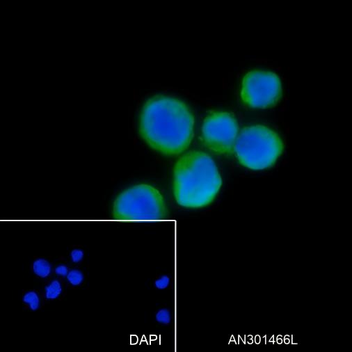 Recombinant CD169 Monoclonal Antibody - 3