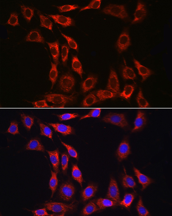 Immunofluorescence analysis of NIH/3T3 cells using CD215/IL-15R alpha Polyclonal Antibody at dilution of 1:100 (40x lens). Blue: DAPI for nuclear staining.