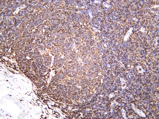 Recombinant Plastin L Monoclonal Antibody - 1