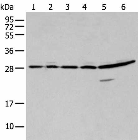 Western blot analysis of 293T A549 and Hela cell  using SFN Polyclonal Antibody at dilution of 1:250