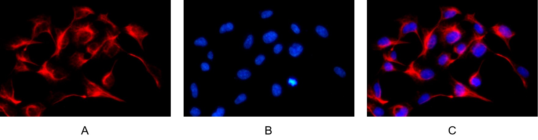 Recombinant Vimentin Monoclonal Antibody - small - 9