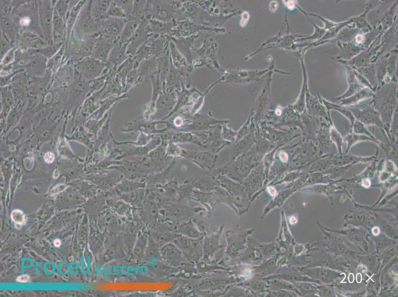 IBRS-2 [IB-RS-2] Cell Complete Medium - small - 5
