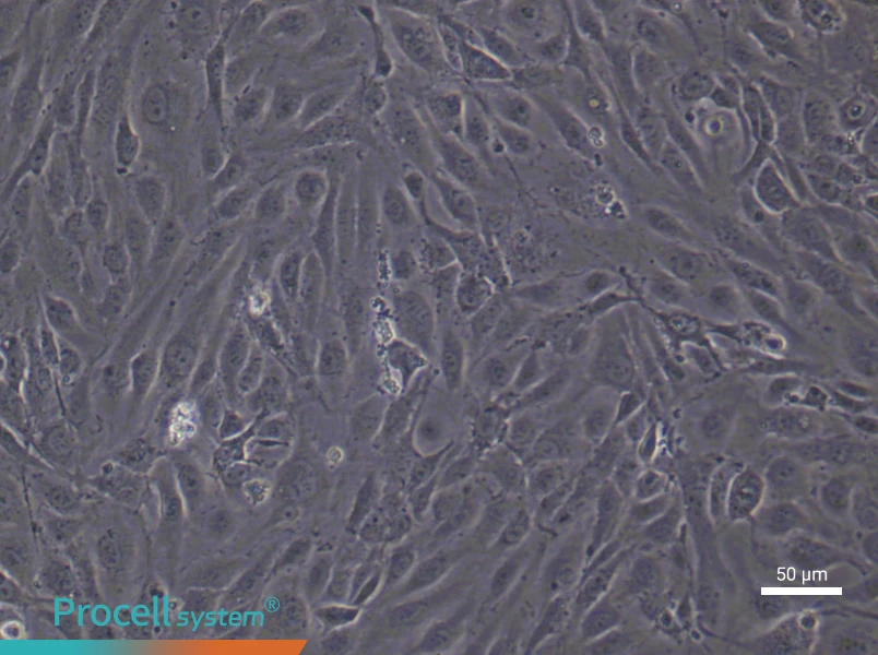 Human Pulmonary Microvascular Endothelial (Primary cell immortalization) Cell Complete MediumHuman Pulmonary Microvascular Endothelial (Primary cell immortalization) Cell Complete Medium - 5