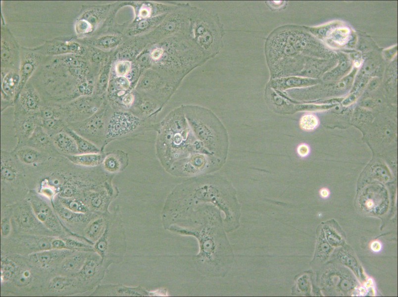MKN-7 [MKN7; MKN 7] Cell Complete Medium - small - 6