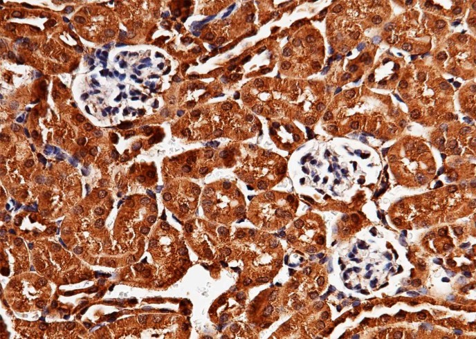 Recombinant LIMP-2/SCARB2/CD36L2 Monoclonal Antibody-searchlist-1