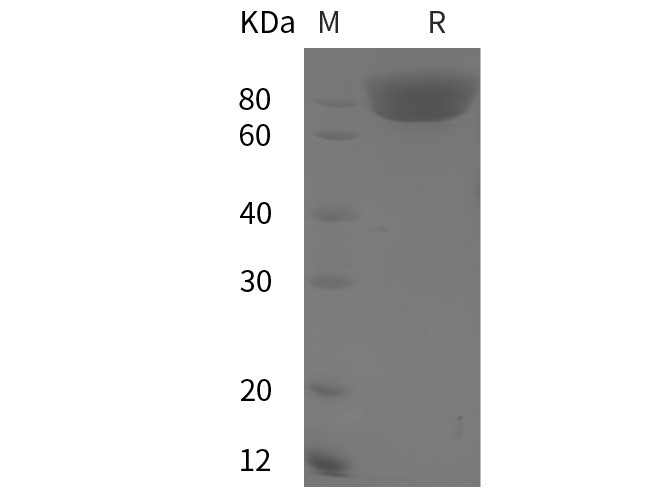 Recombinant Human EGF Protein(Fc Tag)-产品推荐-2