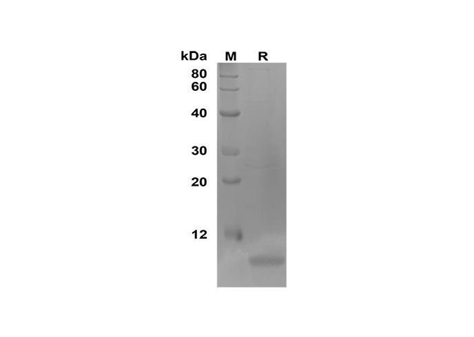 Recombinant Human IL-4 Protein-产品推荐-8