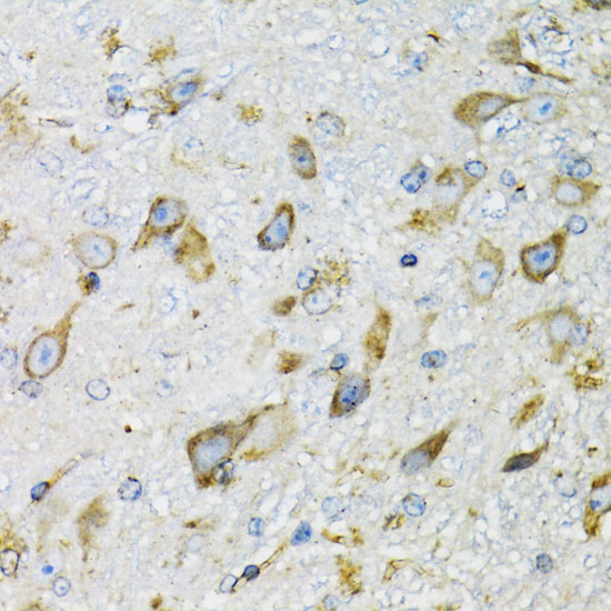 Immunohistochemistry of paraffin-embedded Mouse brain using PDYN Polyclonal Antibody at dilution of 1:100 (40x lens).