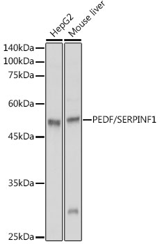 Western blot analysis of extracts of various cell lines using PEDF/SERPINF1 Polyclonal Antibody at 1:1000 dilution.