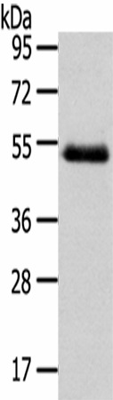 Western Blot analysis of Human placenta tissue using NR2F2 Polyclonal Antibody at dilution of 1/200