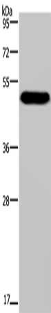 Western Blot analysis of Mouse heart tissue using MAVS Polyclonal Antibody at dilution of 1:250