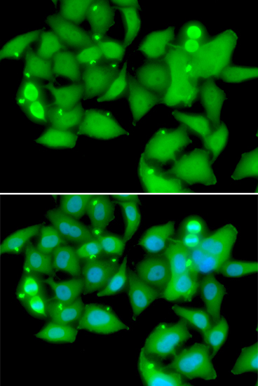 Immunofluorescence analysis of A549 cells using UBASH3B Polyclonal Antibody