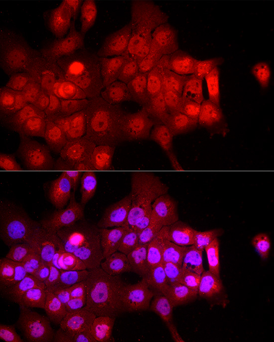 Immunofluorescence analysis of A-431 cells using FBXW11 Polyclonal Antibody at dilution of 1:200 (40x lens). Blue: DAPI for nuclear staining.