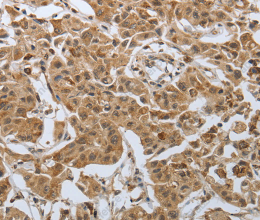 PSMD6 Polyclonal Antibody - 3