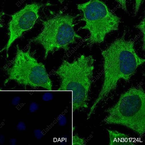 Recombinant SBDS Monoclonal Antibody - 6