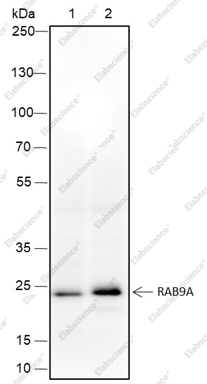 Recombinant Rab9A Monoclonal Antibody - 1