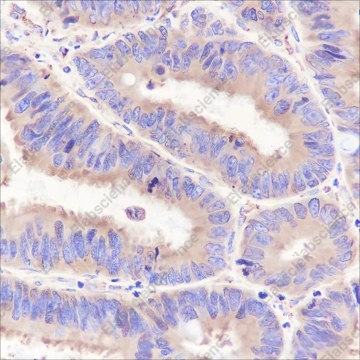 Recombinant GRP94 Monoclonal Antibody - 3