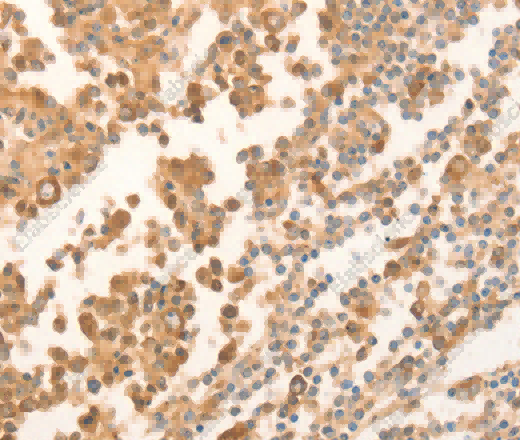 NAP1L1 Polyclonal Antibody - 2