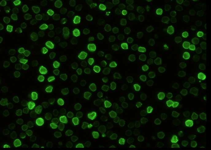 Recombinant CD147/EMMPRIN/Basigin Monoclonal Antibody-searchlist-1