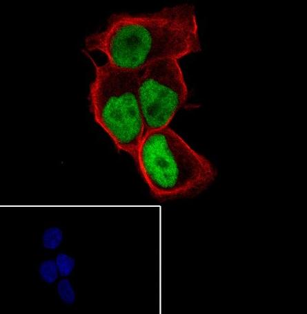 Recombinant MCM7 Monoclonal Antibody - small - 5