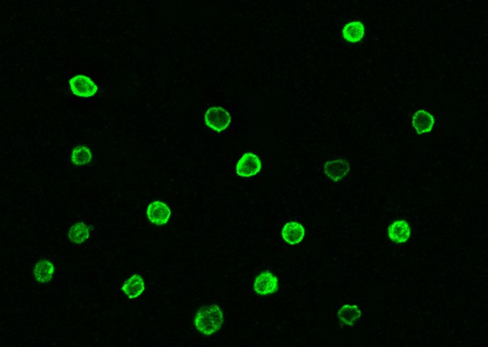 CD5/Cluster of Differentiation 5 Monoclonal Antibody - small - 2