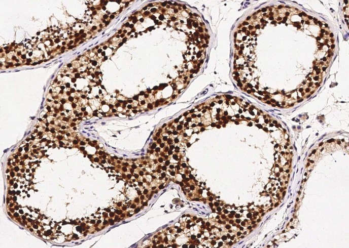 Recombinant ASF1B Monoclonal Antibody-searchlist-1