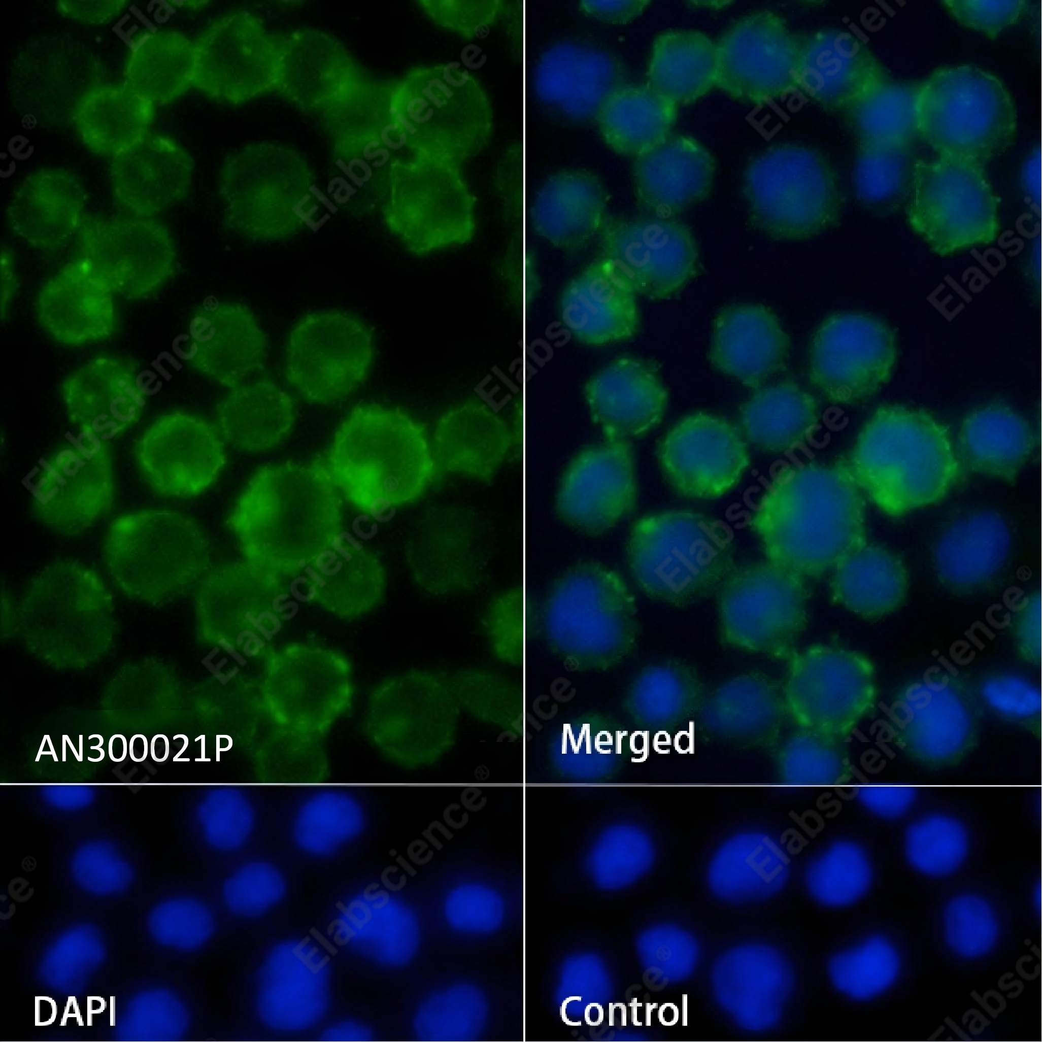 Recombinant Ly108/SLAMF6 Monoclonal Antibody - 2