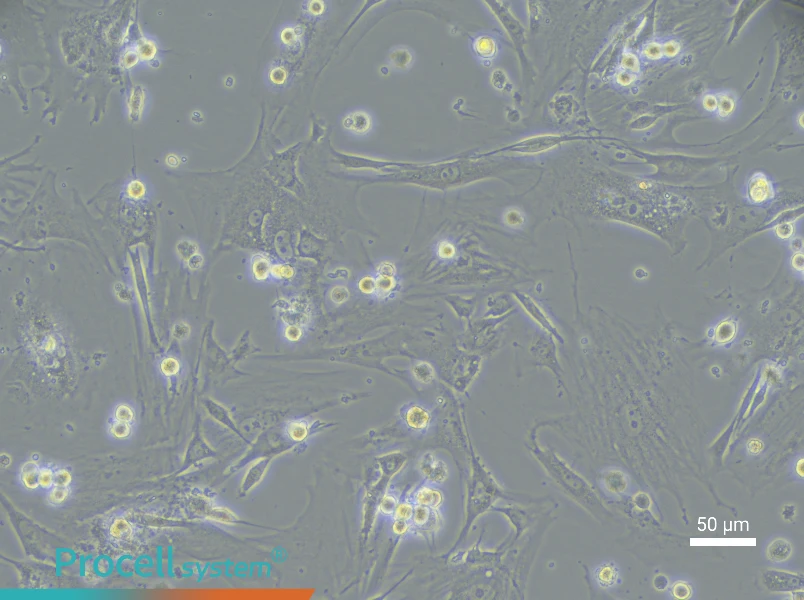 Mouse Vaginal Wall Fibroblast Complete Medium - 5