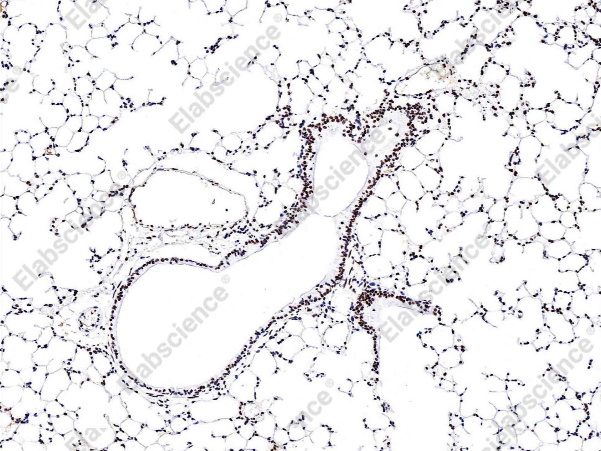 Recombinant Phospho-Stat6 (Tyr641) Monoclonal Antibody - 1